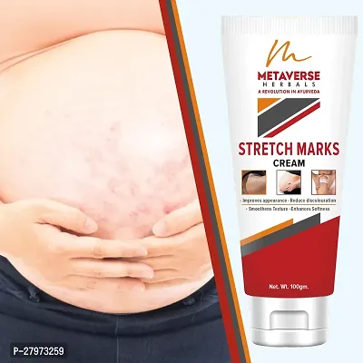 Postpartum Stretch Mark Cream | Stretch Mark Prevention Oil | Stretch Mark Cream for Men | Anti-Stretch Mark Body Butter | Stretch Mark Treatment |-thumb0