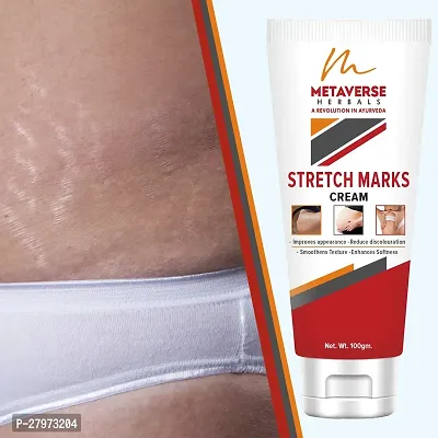 Stretch mark oil | Post-pregnancy stretch mark cream | Effective stretch mark reduction |Stretch mark cream for sensitive skin |Organic stretch mark solution.-thumb0