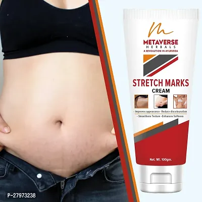 Stretch mark fading cream| Stretch mark minimizer | Stretch mark repair cream | Anti-stretch mark body butter | Stretch mark cream for men  | Stretch  Mark Prevention Oil.-thumb0