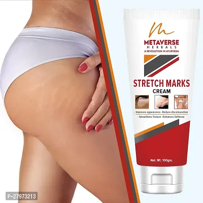 Postpartum Stretch Mark Cream | Stretch Mark Prevention Oil | Stretch Mark Cream for Men | Anti-Stretch Mark Body Butter | Stretch Mark Treatment |-thumb0