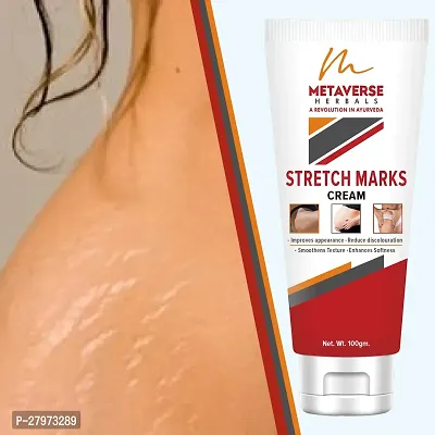 Postpartum Stretch Mark Cream | Stretch Mark Prevention Oil | Stretch Mark Cream for Men | Anti-Stretch Mark Body Butter | Stretch Mark Treatment |-thumb0