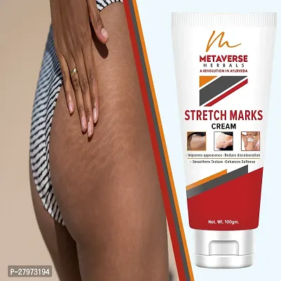 Postpartum Stretch Mark Cream | Stretch Mark Prevention Oil | Stretch Mark Cream for Men | Anti-Stretch Mark Body Butter | Stretch Mark Treatment |-thumb0