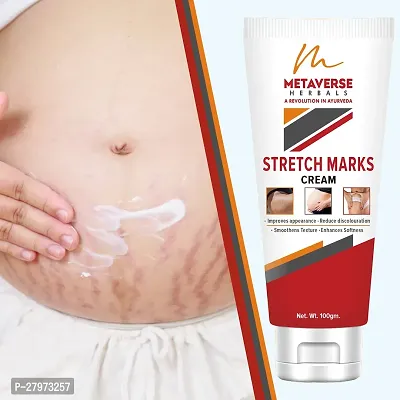 Stretch mark fading cream| Stretch mark minimizer | Stretch mark repair cream | Anti-stretch mark body butter | Stretch mark cream for men  | Stretch  Mark Prevention Oil.-thumb0