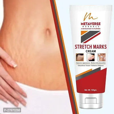 Stretch Mark cream for pregnancy | Stretch Mark lotion | Stretch mark therapy cream | Stretch Mark Creams | Stretch Mark Removal Cream-thumb0