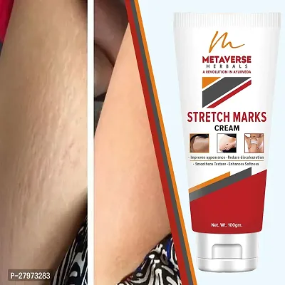 Stretch mark fading cream| Stretch mark minimizer | Stretch mark repair cream | Anti-stretch mark body butter | Stretch mark cream for men  | Stretch  Mark Prevention Oil.-thumb0