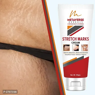 Stretch mark oil | Post-pregnancy stretch mark cream | Effective stretch mark reduction |Stretch mark cream for sensitive skin |Organic stretch mark solution.-thumb0