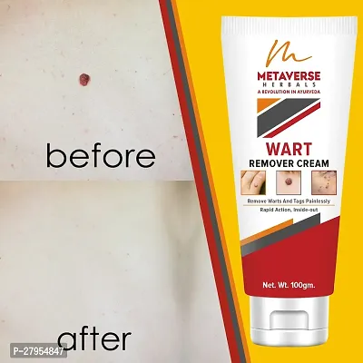 Wart Removal Cream for Men  Women Facial Skin Care Wart Remover Ointment-thumb0