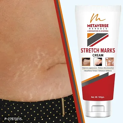 Stretch Marks Cream | Pregnancy Stretch Marks Cream | Anti-stretch mark body butter | Natural stretch mark cream | Stretch mark oil |Stretch Mark Pregnancy Mark Remover | Stretch Marks Scar Removal Cream-thumb0