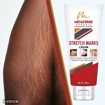 Stretch Marks Cream | Pregnancy Stretch Marks Cream | Anti-stretch mark body butter | Natural stretch mark cream | Stretch mark oil |Stretch Mark Pregnancy Mark Remover | Stretch Marks Scar Removal Cream-thumb0