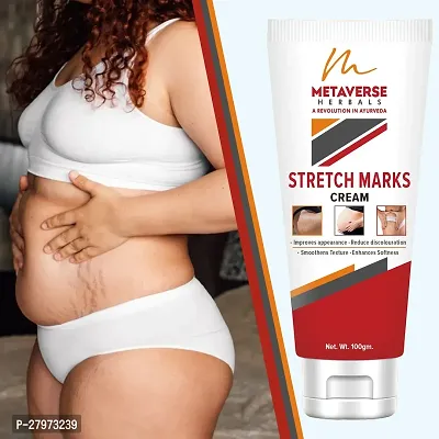 Stretch Mark cream for pregnancy | Stretch Mark lotion | Stretch mark therapy cream | Stretch Mark Creams | Stretch Mark Removal Cream