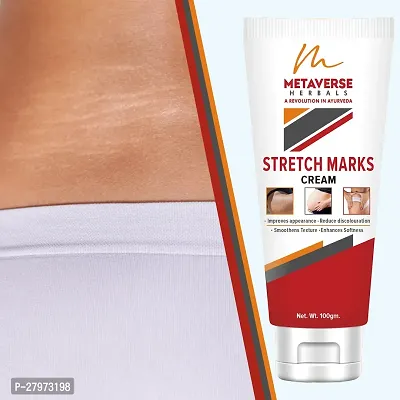 Stretch mark fading cream| Stretch mark minimizer | Stretch mark repair cream | Anti-stretch mark body butter | Stretch mark cream for men  | Stretch  Mark Prevention Oil.-thumb0