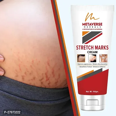 Stretch Marks Cream | Pregnancy Stretch Marks Cream | Anti-stretch mark body butter | Natural stretch mark cream | Stretch mark oil |Stretch Mark Pregnancy Mark Remover | Stretch Marks Scar Removal Cream-thumb0