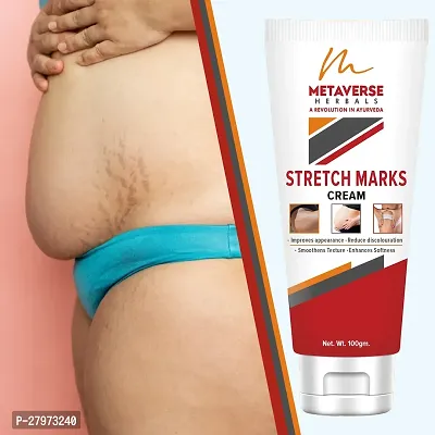 Postpartum Stretch Mark Cream | Stretch Mark Prevention Oil | Stretch Mark Cream for Men | Anti-Stretch Mark Body Butter | Stretch Mark Treatment |-thumb0