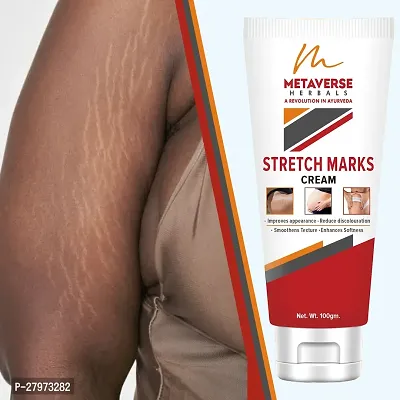 Stretch mark oil | Post-pregnancy stretch mark cream | Effective stretch mark reduction |Stretch mark cream for sensitive skin |Organic stretch mark solution.-thumb0