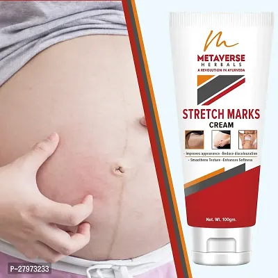 Stretch Mark cream for pregnancy | Stretch Mark lotion | Stretch mark therapy cream | Stretch Mark Creams | Stretch Mark Removal Cream-thumb0