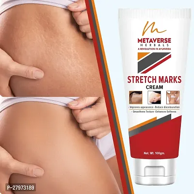 Stretch Marks Cream | Pregnancy Stretch Marks Cream | Anti-stretch mark body butter | Natural stretch mark cream | Stretch mark oil |Stretch Mark Pregnancy Mark Remover | Stretch Marks Scar Removal Cream-thumb0