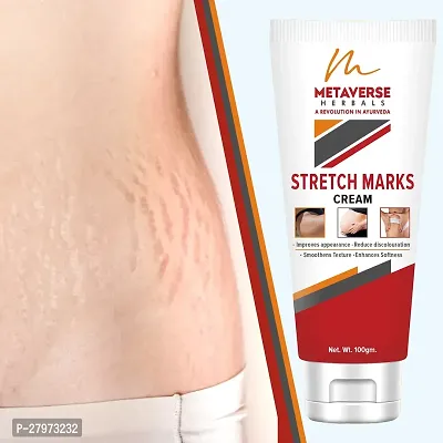 Stretch mark fading cream| Stretch mark minimizer | Stretch mark repair cream | Anti-stretch mark body butter | Stretch mark cream for men  | Stretch  Mark Prevention Oil.-thumb0