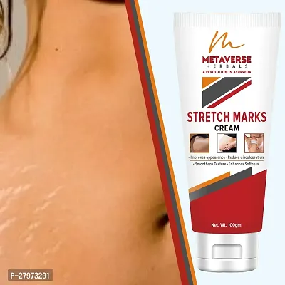 Best stretch mark cream | Pregnancy stretch mark removal | Stretch mark prevention cream | Stretch mark treatment | Natural stretch mark cream.-thumb0