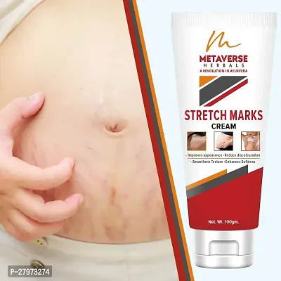 Best stretch mark cream | Pregnancy stretch mark removal | Stretch mark prevention cream | Stretch mark treatment | Natural stretch mark cream.-thumb0