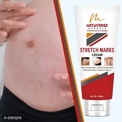 Stretch mark oil | Post-pregnancy stretch mark cream | Effective stretch mark reduction |Stretch mark cream for sensitive skin |Organic stretch mark solution.-thumb0