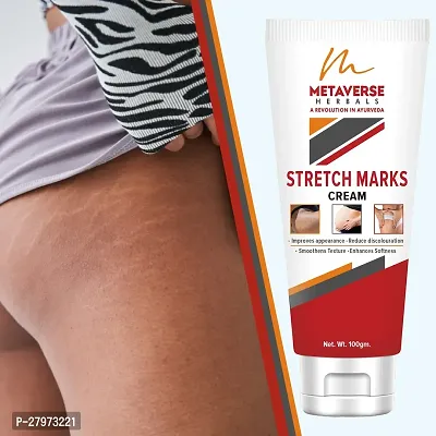 Postpartum Stretch Mark Cream | Stretch Mark Prevention Oil | Stretch Mark Cream for Men | Anti-Stretch Mark Body Butter | Stretch Mark Treatment |-thumb0