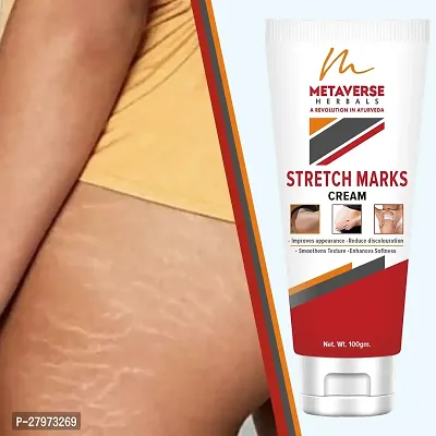 Stretch mark oil | Post-pregnancy stretch mark cream | Effective stretch mark reduction |Stretch mark cream for sensitive skin |Organic stretch mark solution.-thumb0