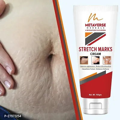 Stretch Marks Cream | Pregnancy Stretch Marks Cream | Anti-stretch mark body butter | Natural stretch mark cream | Stretch mark oil |Stretch Mark Pregnancy Mark Remover | Stretch Marks Scar Removal Cream-thumb0