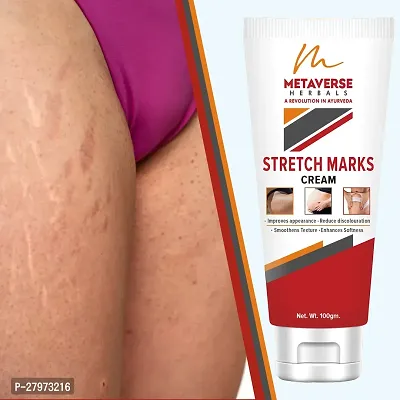 Best stretch mark cream | Pregnancy stretch mark removal | Stretch mark prevention cream | Stretch mark treatment | Natural stretch mark cream.-thumb0