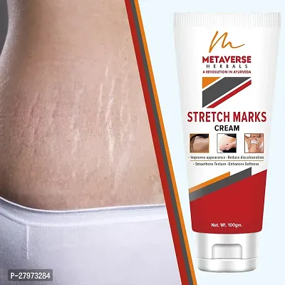 Stretch Mark cream for pregnancy | Stretch Mark lotion | Stretch mark therapy cream | Stretch Mark Creams | Stretch Mark Removal Cream-thumb0