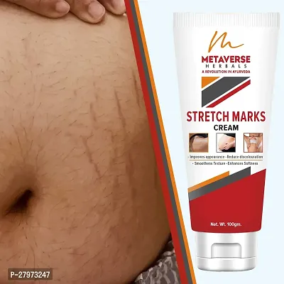 Stretch Marks Cream | Pregnancy Stretch Marks Cream | Anti-stretch mark body butter | Natural stretch mark cream | Stretch mark oil |Stretch Mark Pregnancy Mark Remover | Stretch Marks Scar Removal Cream-thumb0