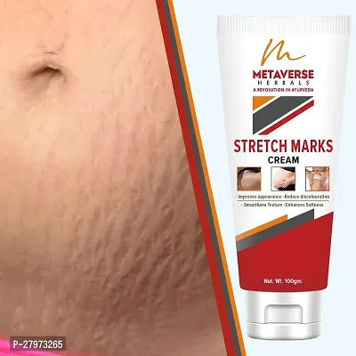 Stretch Mark cream for pregnancy | Stretch Mark lotion | Stretch mark therapy cream | Stretch Mark Creams | Stretch Mark Removal Cream-thumb0