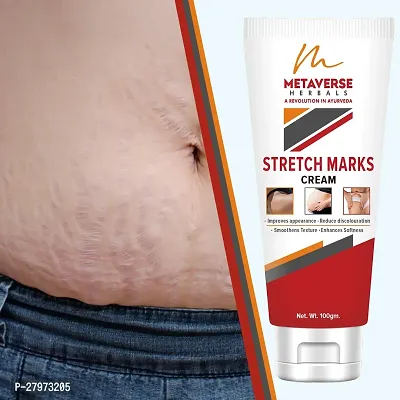 Stretch mark fading cream| Stretch mark minimizer | Stretch mark repair cream | Anti-stretch mark body butter | Stretch mark cream for men  | Stretch  Mark Prevention Oil.-thumb0