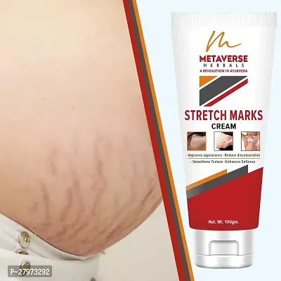 Stretch mark oil | Post-pregnancy stretch mark cream | Effective stretch mark reduction |Stretch mark cream for sensitive skin |Organic stretch mark solution.-thumb0