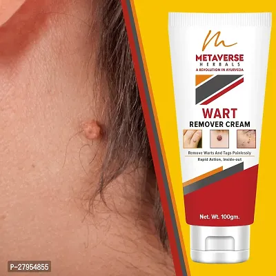 Men  Women Wart Removal Cream Facial Skin Care Wart Remover Ointment-thumb0