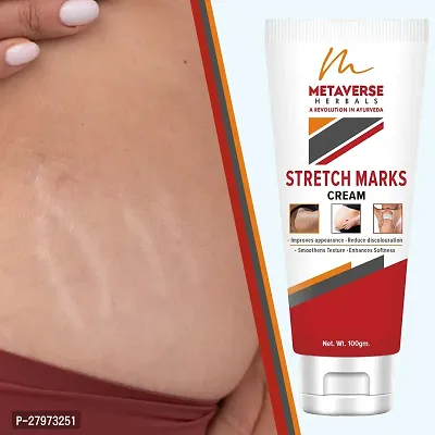 Stretch Mark cream for pregnancy | Stretch Mark lotion | Stretch mark therapy cream | Stretch Mark Creams | Stretch Mark Removal Cream-thumb0