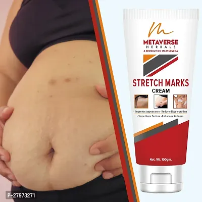 Stretch Mark cream for pregnancy | Stretch Mark lotion | Stretch mark therapy cream | Stretch Mark Creams | Stretch Mark Removal Cream-thumb0