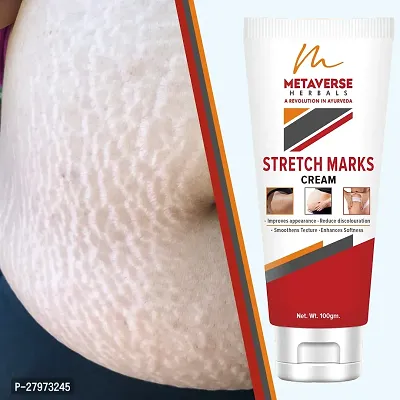 Stretch Mark cream for pregnancy | Stretch Mark lotion | Stretch mark therapy cream | Stretch Mark Creams | Stretch Mark Removal Cream-thumb0