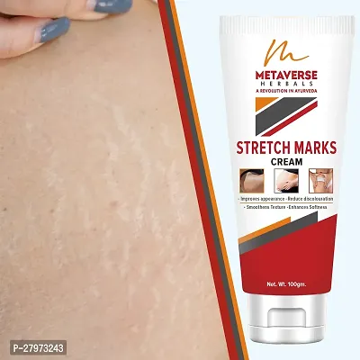 Stretch mark oil | Post-pregnancy stretch mark cream | Effective stretch mark reduction |Stretch mark cream for sensitive skin |Organic stretch mark solution.-thumb0