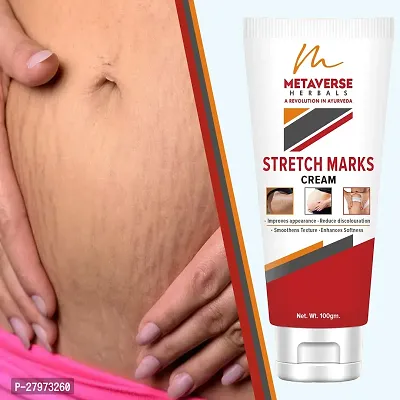 Stretch Marks Cream | Pregnancy Stretch Marks Cream | Anti-stretch mark body butter | Natural stretch mark cream | Stretch mark oil |Stretch Mark Pregnancy Mark Remover | Stretch Marks Scar Removal Cream-thumb0