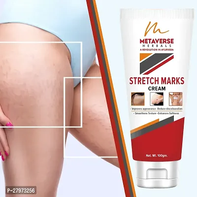 Stretch mark oil | Post-pregnancy stretch mark cream | Effective stretch mark reduction |Stretch mark cream for sensitive skin |Organic stretch mark solution.-thumb0