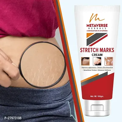 Postpartum Stretch Mark Cream | Stretch Mark Prevention Oil | Stretch Mark Cream for Men | Anti-Stretch Mark Body Butter | Stretch Mark Treatment |-thumb0