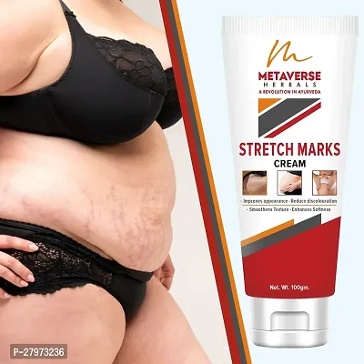 Best stretch mark cream | Pregnancy stretch mark removal | Stretch mark prevention cream | Stretch mark treatment | Natural stretch mark cream.-thumb0