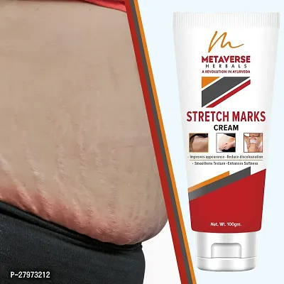 Stretch Mark cream for pregnancy | Stretch Mark lotion | Stretch mark therapy cream | Stretch Mark Creams | Stretch Mark Removal Cream-thumb0