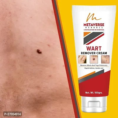 Men  Women Wart Removal Cream Wart Remover Ointment for Facial Skin Care-thumb0