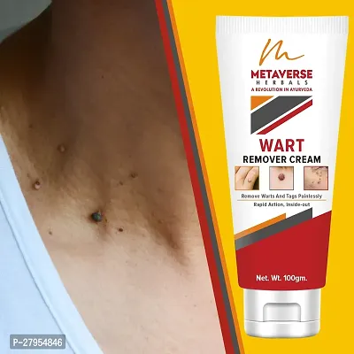 Wart Remover Ointment Face Skin Care Wart Removal Cream for Men  Women-thumb0