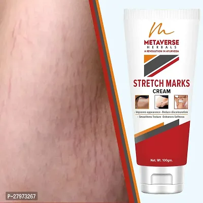 Stretch Marks Cream | Pregnancy Stretch Marks Cream | Anti-stretch mark body butter | Natural stretch mark cream | Stretch mark oil |Stretch Mark Pregnancy Mark Remover | Stretch Marks Scar Removal Cream-thumb0