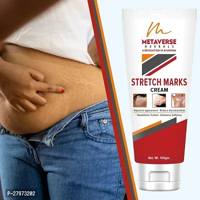 Stretch Marks Cream | Pregnancy Stretch Marks Cream | Anti-stretch mark body butter | Natural stretch mark cream | Stretch mark oil |Stretch Mark Pregnancy Mark Remover | Stretch Marks Scar Removal Cream-thumb0