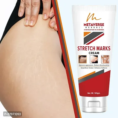 Stretch mark oil | Post-pregnancy stretch mark cream | Effective stretch mark reduction |Stretch mark cream for sensitive skin |Organic stretch mark solution.-thumb0