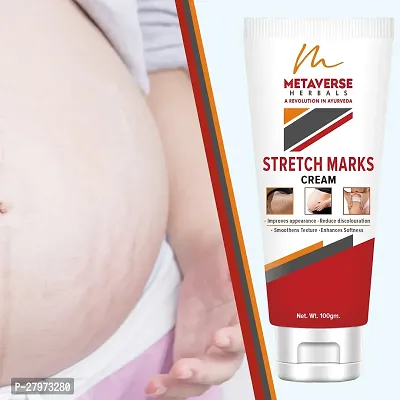 Stretch Marks Cream | Pregnancy Stretch Marks Cream | Anti-stretch mark body butter | Natural stretch mark cream | Stretch mark oil |Stretch Mark Pregnancy Mark Remover | Stretch Marks Scar Removal Cream-thumb0