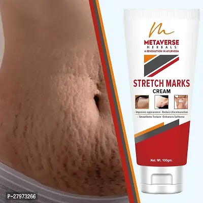 Postpartum Stretch Mark Cream | Stretch Mark Prevention Oil | Stretch Mark Cream for Men | Anti-Stretch Mark Body Butter | Stretch Mark Treatment |-thumb0